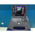 Ultrasonido portátil del ultrasonido del ordenador portátil del ultrasonido de Doppler del color digital Precio Escáner portátil del ultrasonido 3D